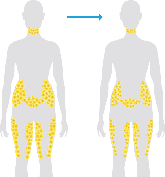 Normal Weight Loss